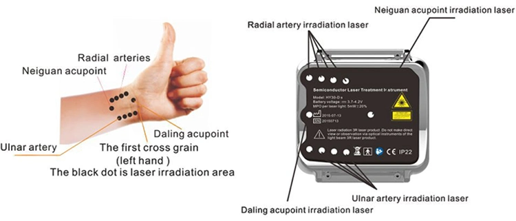 Cardiovascular and Cerebrovascular Diseases Soft Laser Medical Device